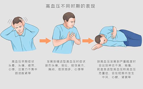 動脈硬化檢測儀