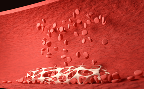 動(dòng)脈硬化檢測(cè)儀