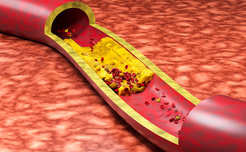 動脈硬化檢測儀