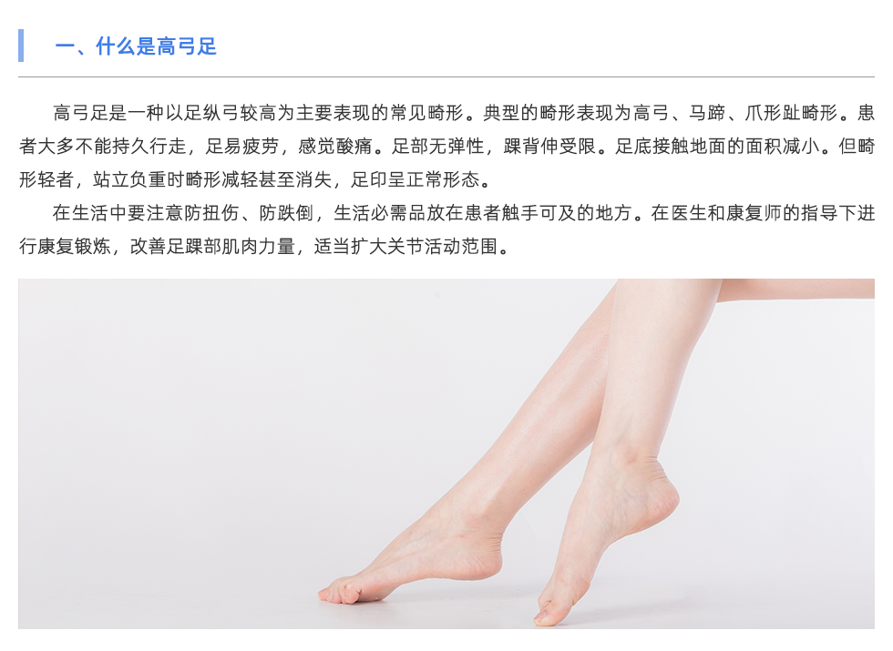 步態(tài)分析設備