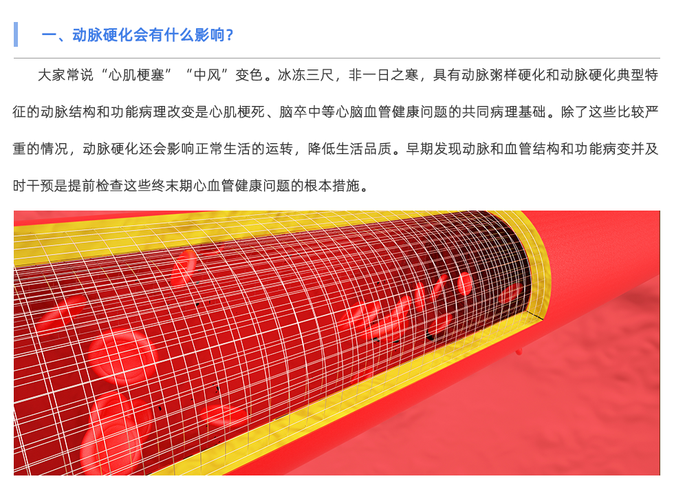 動脈硬化檢測儀