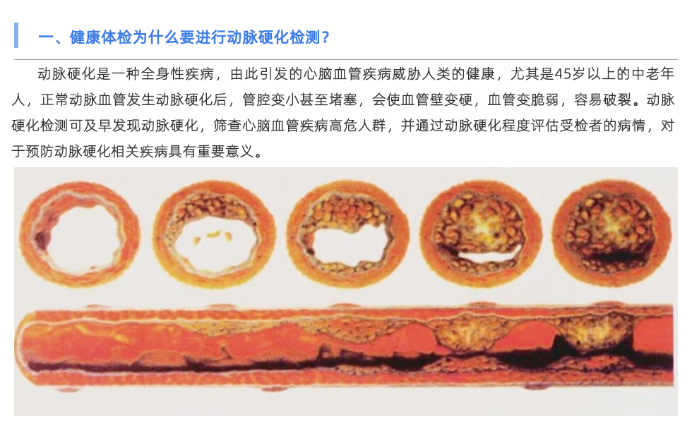 動脈硬化檢測儀