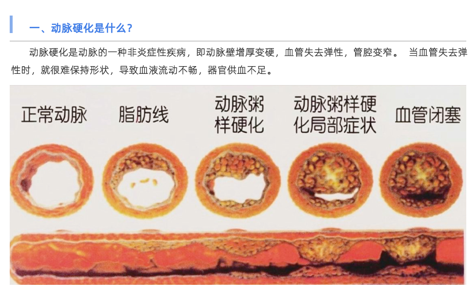 動(dòng)脈硬化檢測(cè)儀