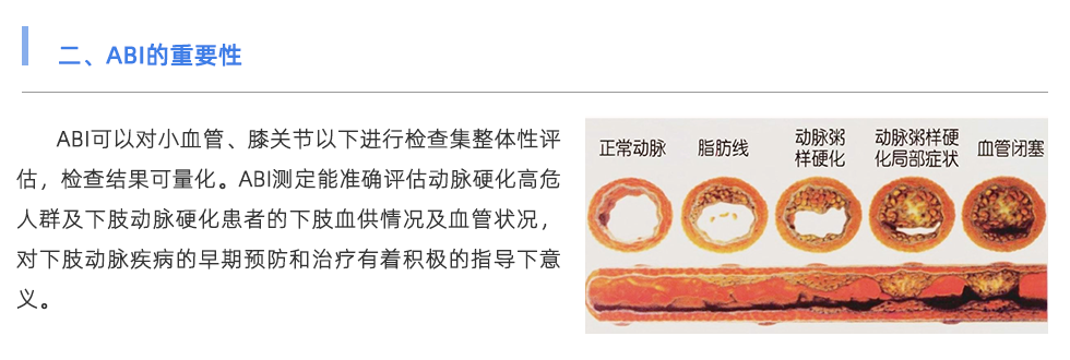 動脈硬化檢測儀