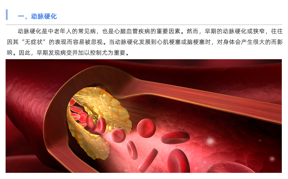 動脈硬化檢測儀