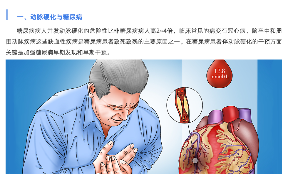 動脈硬化檢測儀