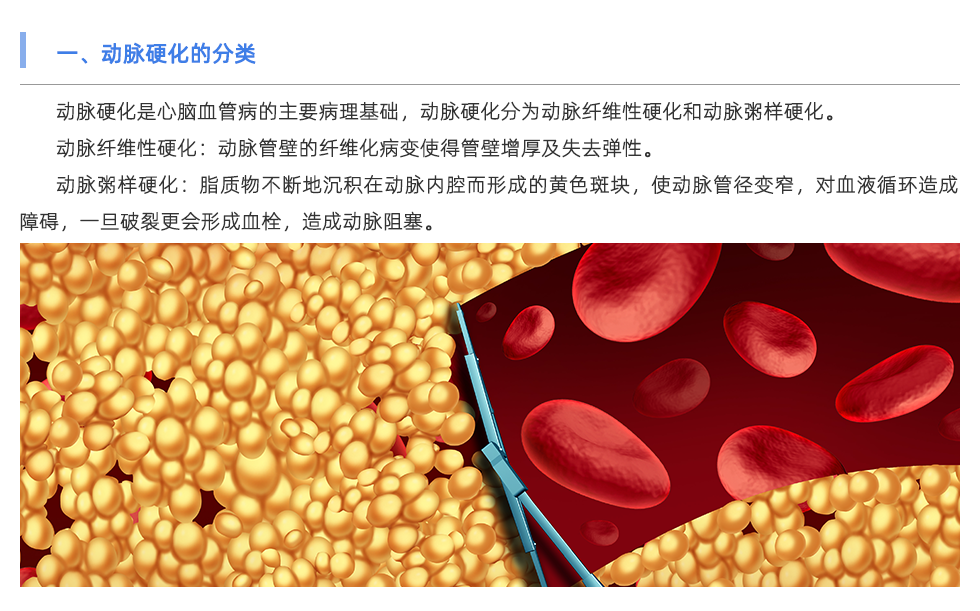 動脈硬化檢測儀