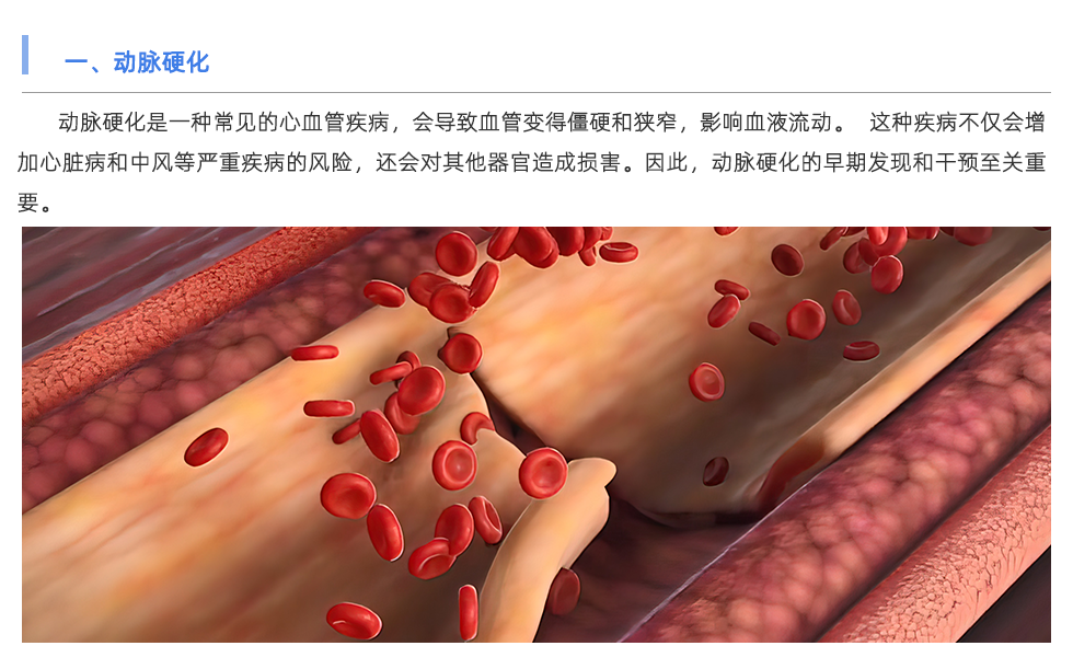 動(dòng)脈硬化檢測(cè)儀
