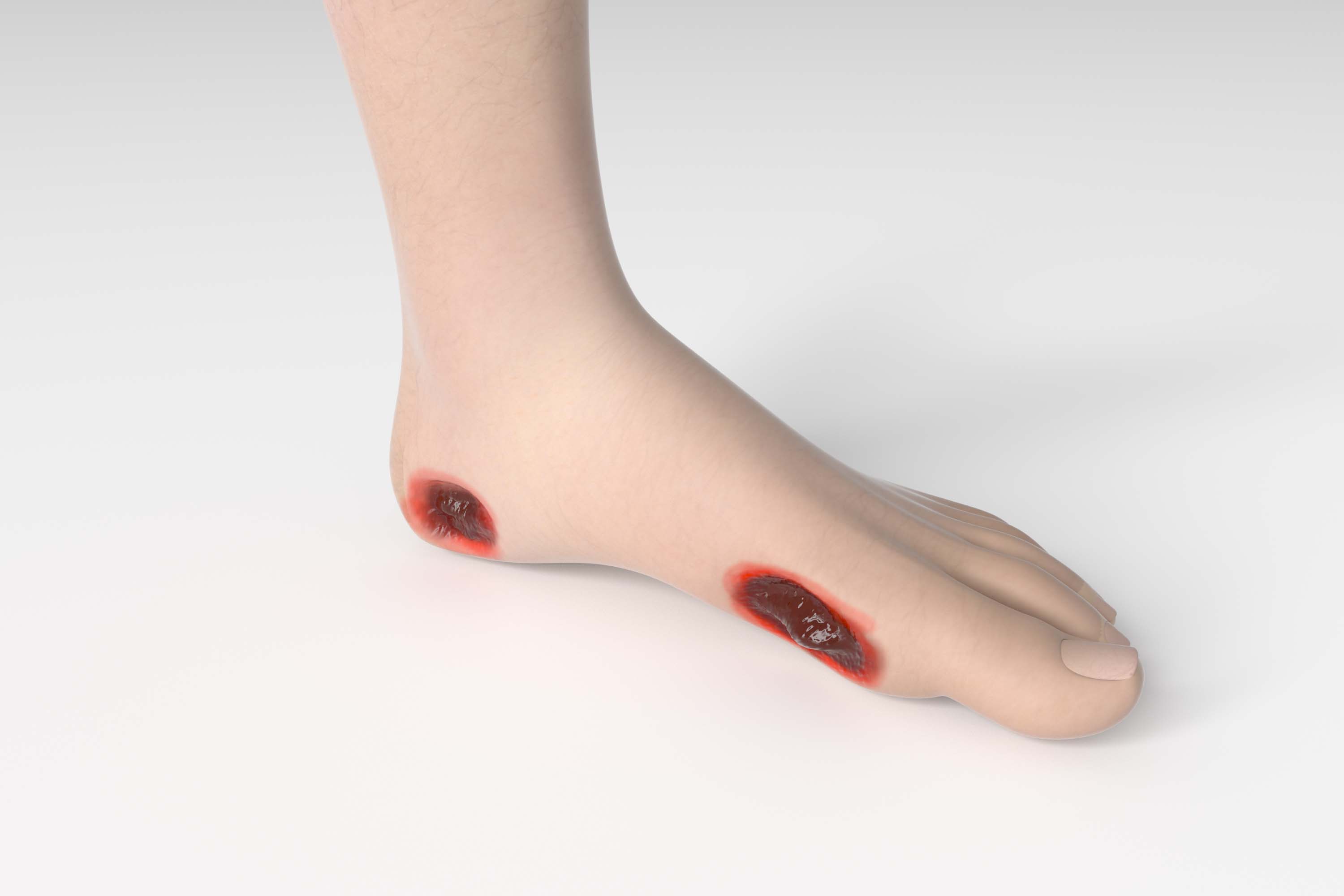 足底壓力分析系統(tǒng)